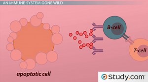 Systemic Lupus Erythematosus (SLE): Causes, Signs & Treatments