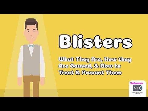 Blisters - What They Are, How they Are Caused, & How to Treat & Prevent Them