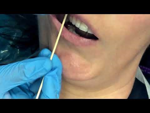 Middle Superior Alveolar (MSA) Nerve Block
