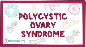 Polycystic ovary syndrome: Video, Causes, & Meaning | Osmosis