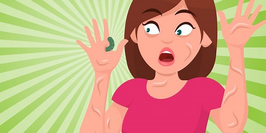 The bugs that lay eggs all over your body