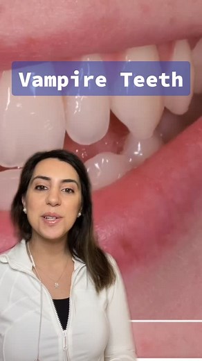 How to Sharpen Your Canine Teeth at Home