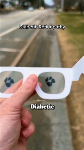 This is what blind people actually see