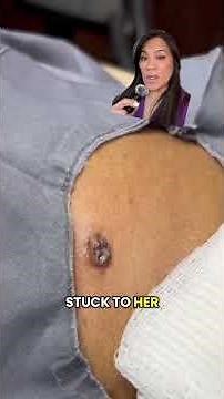 This Weird Bump Has a Sticky Secret!