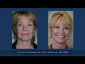 CO2 Resurfacing Laser Recovery