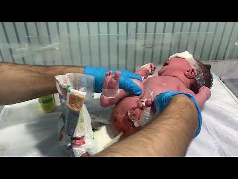 How to Help a Constipated Newborn | Suppository Guide for Parents 😱