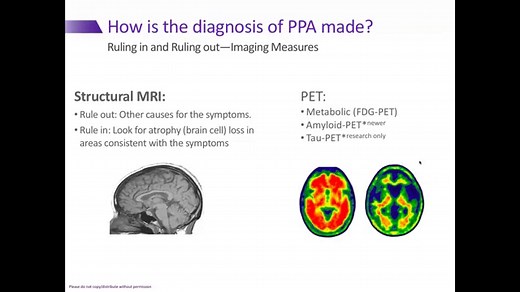 Nonfluent/Agrammatic PPA (Primary Progressive Aphasia) | AFTD