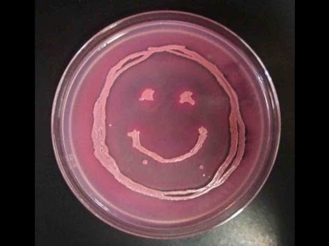 How to Interpret MacConkey's Agar Bacterial Growth Medium