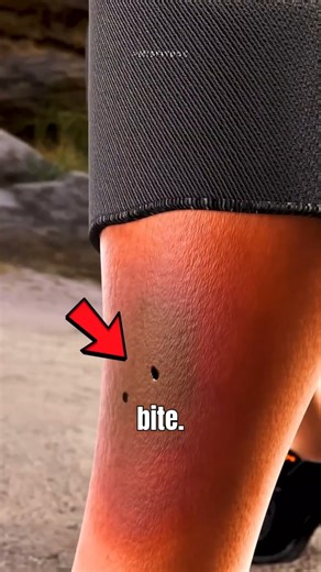 The Difference Between Venomous and Non-Venomous Snake!🤔