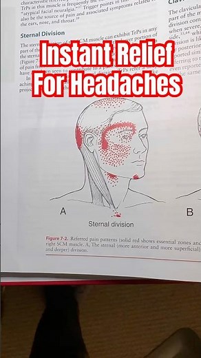 I Tried 10 Instant Headache Remedies