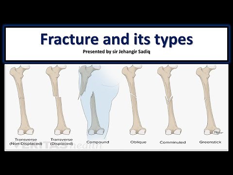 Fracture and its types