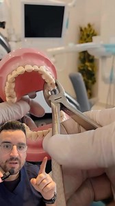 3.8K views · 973 reactions | ️Extraction dentaire avec le davier :...
