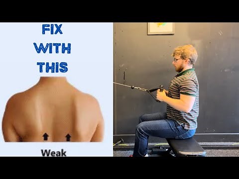 5 Exercises That Fix Scapular Winging | Complete Guide and Workout Plan 💪✅