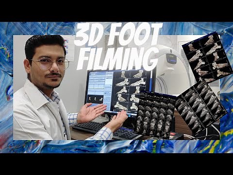 CT SCAN 3D FOOT FILMING PROCESS & TECHNIQUES ON GE MACHINE #radiologytechnologist #ctscan