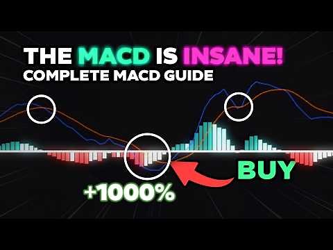 How To Trade MACD In UNDER 10 Minutes!
