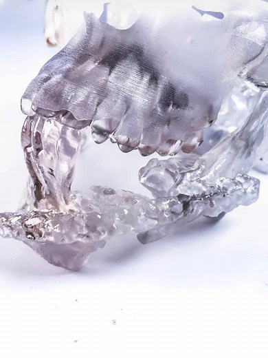 How to 3D print a DICOM file step by step tutorial - Medimodel