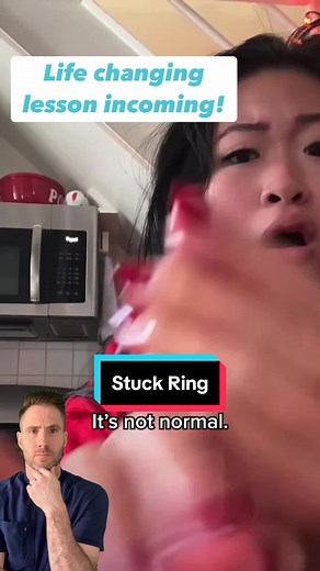 The string method for ring removal is a simple and effective technique used to remove a ring from a swollen finger without cutting the ring. This method involves wrapping a thin string or dental floss tightly around the finger starting from the tip, just beyond the ring, and moving downward toward the base of the finger. The end of the string is then threaded through the ring. By slowly unwinding the string from the underside of the ring, the ring is gradually pushed over the swollen part of the