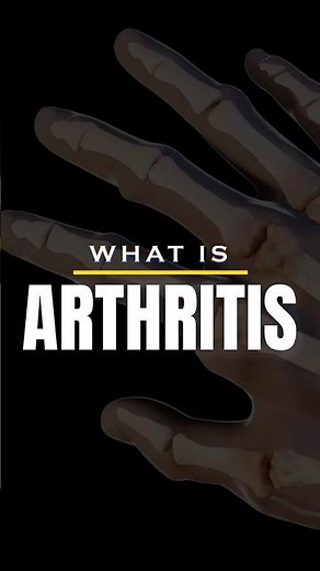 What Is Arthritis? 🦴
