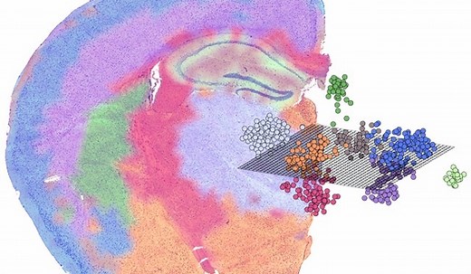 Mining the transcriptome using spatial transcriptomics: Comprehensive 2D or 3D visualization of all mRNAs in tissue sections