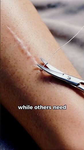 How Stitches Actually Work 😯 | Quick Science Explained