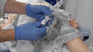 24K views · 847 reactions | How to setup Arterial line Transducer. | ICU Critical Care Nurses | Facebook