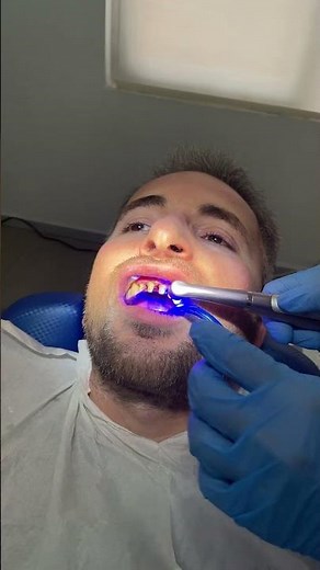 Printing New Teeth with 3D Printer (CEREC)