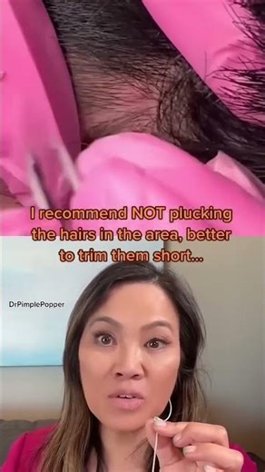 Dr Pimple Popper Reacts to Pustles!