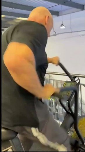 6 Weeks After Keyhole Triple Heart Bypass Surgery, An Amazing Recovery