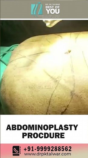 Unveiling the Tummy Tuck Procedure: Step-by-Step Guide to Abdominoplasty | Dr. PK Talwar