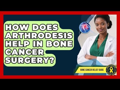 How Does Arthrodesis Help In Bone Cancer Surgery? - Bone Cancer Relief Guide