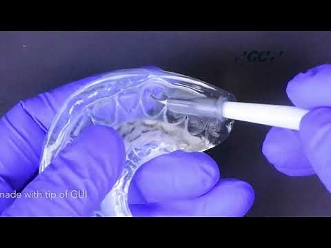 Injection moulding technique with GC Exaclear, Gaenial Universal Injectable