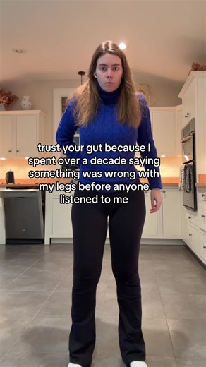 Understanding Lipedema: My Personal Journey