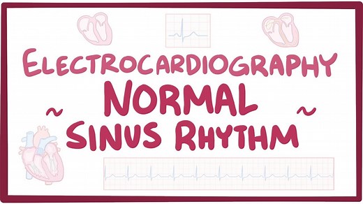 ECG normal sinus rhythm: Video, Causes, & Meaning | Osmosis