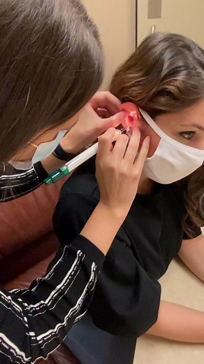 Satisfying, don’t ya think? #concertplugs #custommolds #tinnitus #hearing #hearingloss #noiseinducedhearingloss #audiologist #ears