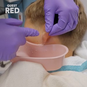 2.2M views · 18K reactions | Did they manage to get the bug out? 﫣烈 #ThisCameOutOfMe | QUEST RED | Facebook