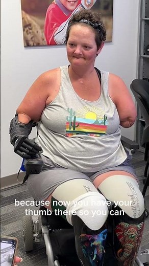 Quad amputee Kristin receives her bionic arm!