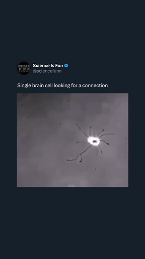 The links between neurons are called synapses. What exactly is a synapse, and what happens there? It’s basically a connection: one cell talking to another. A brain cell, or a neuron, has a large main body, with small strands sticking out.If you enjoyed this post, please give it a ❤️ and check out @sciencefunn for more science and daily facts. Video credit: unknown (please DM me if you know/are the creator) #science #biology #facts | Science Is Fun For Everyone
