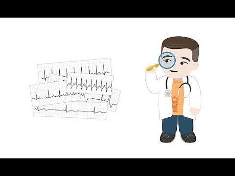 Making sense of common Holter ECG findings