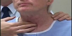 Thyroid Examination