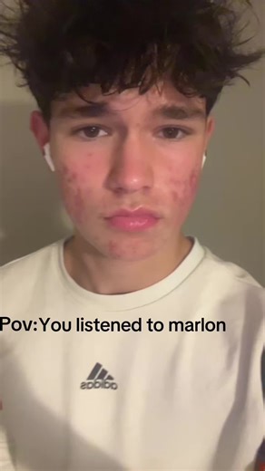 @Marlon #marlon #glowup #looksmaxing #bp #fy | marlon
