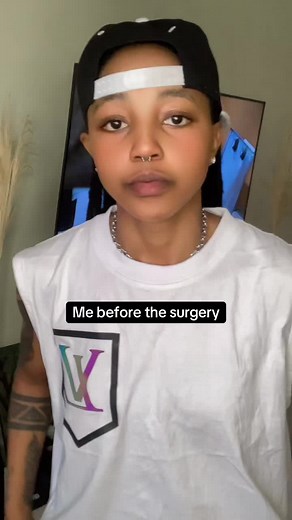 Understanding Surgery Experiences of Transgender Individuals