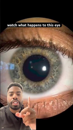 Why eyes move on their own. Nystagmus (explained)