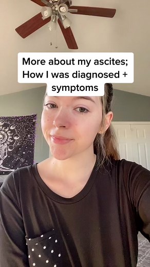 Understanding Ascites: Symptoms and Causes Explained