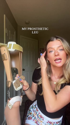 For those wondering about my leg and how it works! 🦿🩺 #prostheticleg #rotationplasty #childhoodcancer #prosthetic #amputeelife #amputeegirl #fyp #viral