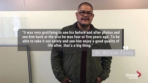 California man’s ‘beer belly’ turns out to be 77-lb tumour