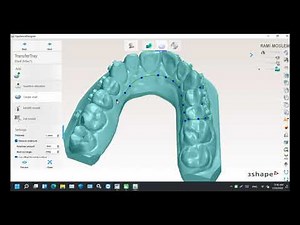 Transfer Media Tray Design in 3Shape : Simplified Workflow