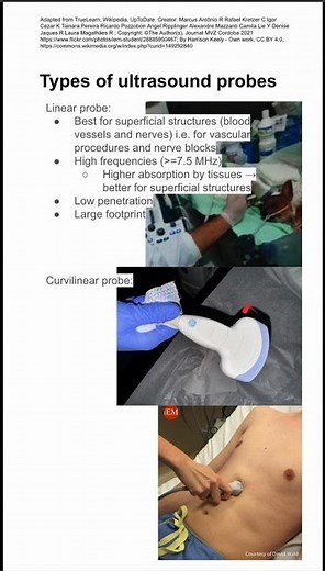 Types of ultrasound probes