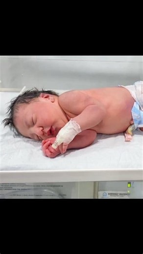 15K views · 169 reactions | Congenital microcephaly is a condition...