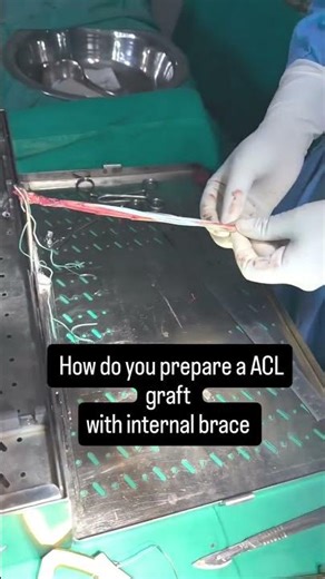 ACL Graft + Internal Brace: Stronger, Safer Comeback! | Dr Aditya Jain #ACLRecovery