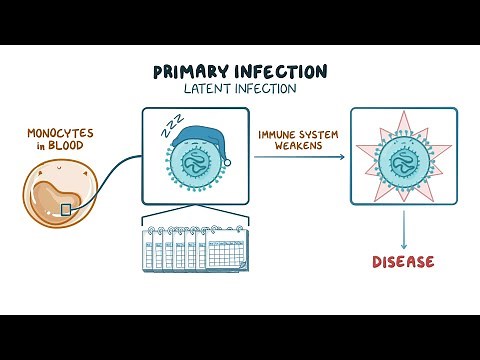 Understanding Cytomegalovirus (CMV) Infection After Transplant